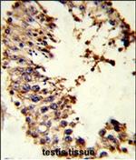 Acrosin Polyclonal Antibody
