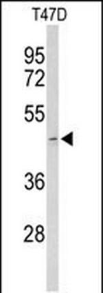 Acrosin Antibody in Western Blot (WB)