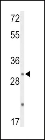 DUSP2 Polyclonal Antibody