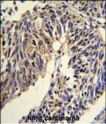 TNFRSF14 Polyclonal Antibody
