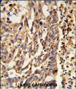 KIF11 Polyclonal Antibody