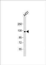KIF11 Antibody in Western Blot (WB)