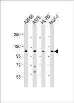 COL17A1 Polyclonal Antibody