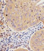 GCLM Antibody in Immunohistochemistry (Paraffin) (IHC (P))