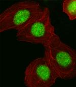 HMGA1 Polyclonal Antibody