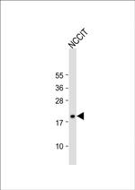 HMGA1 Antibody in Western Blot (WB)