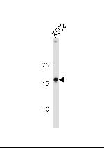 HMGA1 Antibody in Western Blot (WB)