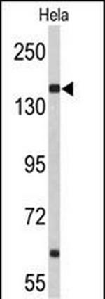 NUP153 Polyclonal Antibody