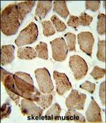 ULK1 (denatured) Polyclonal Antibody