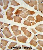 AMPD2 Polyclonal Antibody