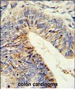 ADAMDEC1 Polyclonal Antibody
