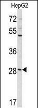 DIPA Antibody in Western Blot (WB)