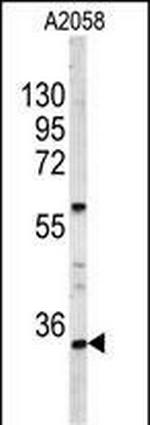 HOXA9 Polyclonal Antibody