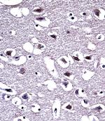 OPRM1 Polyclonal Antibody