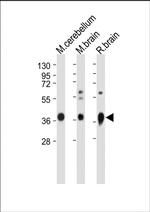 GNAO1 Polyclonal Antibody