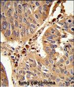 PEX16 Polyclonal Antibody