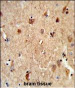 CES7 Polyclonal Antibody