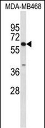 CES7 Antibody in Western Blot (WB)