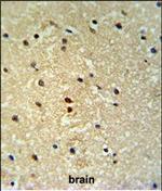 PROX1 Polyclonal Antibody
