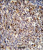 KIR3DL3 Polyclonal Antibody