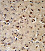 TPH2 Antibody in Immunohistochemistry (Paraffin) (IHC (P))