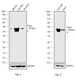 TPH2 Antibody in Western Blot (WB)