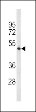 TPH2 Antibody in Western Blot (WB)