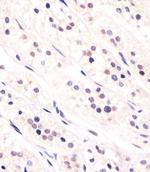 Cdc73 Antibody in Immunohistochemistry (Paraffin) (IHC (P))