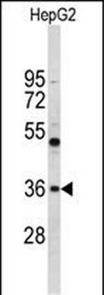 ELOVL2 Antibody in Western Blot (WB)