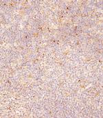 FCGR1B Antibody in Immunohistochemistry (Paraffin) (IHC (P))