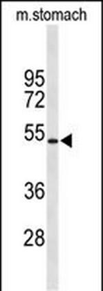 Kir6.2 (KCNJ11) Polyclonal Antibody