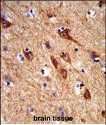 ASIC2 Polyclonal Antibody
