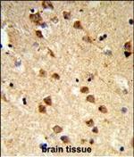 Ataxin 3 Polyclonal Antibody