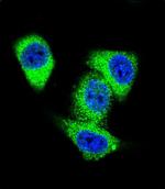 TOP2A Polyclonal Antibody