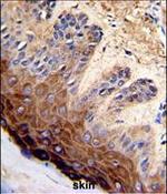 TOP2A Antibody in Immunohistochemistry (Paraffin) (IHC (P))