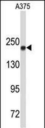 TOP2A Antibody in Western Blot (WB)