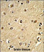 PLCB2 Polyclonal Antibody