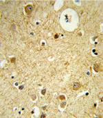 RECK Polyclonal Antibody