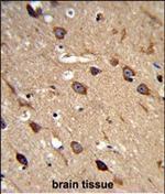 ASIC1 Polyclonal Antibody