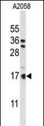 PTMS Antibody in Western Blot (WB)