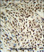 SNRPD3 Polyclonal Antibody