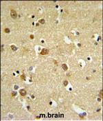 GABRD Polyclonal Antibody