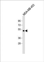 GABRD Antibody in Western Blot (WB)