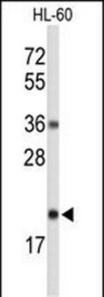 RNaseH2C Polyclonal Antibody