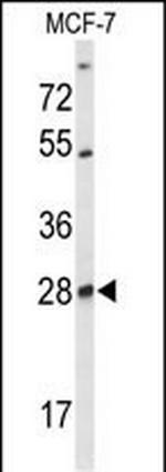 SELT Polyclonal Antibody