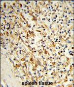 LPCAT1 Polyclonal Antibody