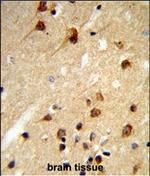 CENPK Polyclonal Antibody
