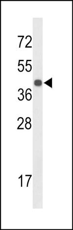 CENPK Antibody in Western Blot (WB)