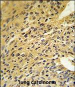 COQ5 Polyclonal Antibody