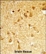 DDX17 Polyclonal Antibody